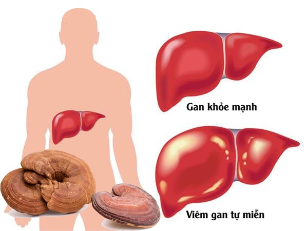 Nấm Linh Chi - Dược liệu quý đối với bệnh nhân gan 2