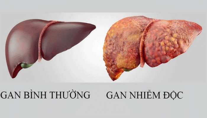 Dùng Nấm Linh Chi như thế nào để thanh lọc cơ thể ? 1