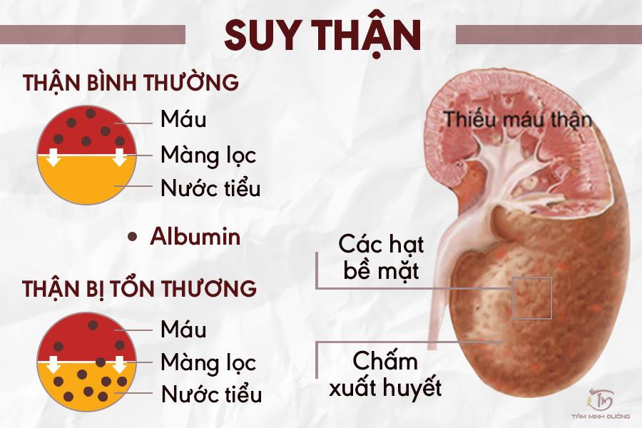 Người bị suy thận có nên uống nấm linh chi không ? 1