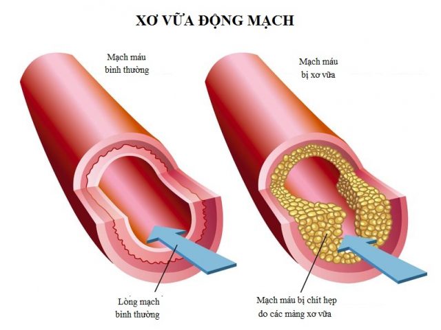 Nấm Linh Chi rất tốt cho tim mạch, đúng hay sai ? 2