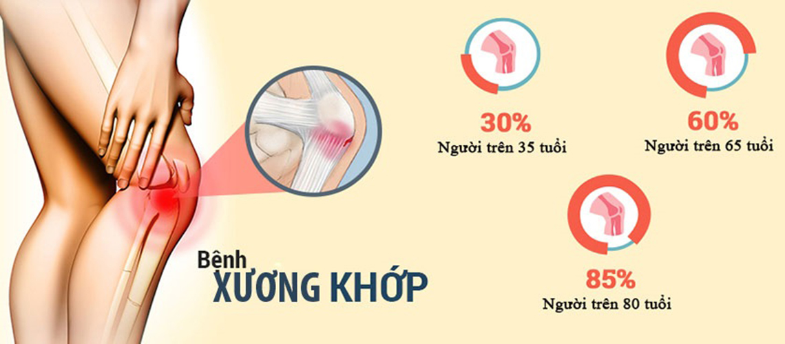 Cao hồng sâm linh chi có thực sự tốt cho người bệnh đau xương khớp ? 1